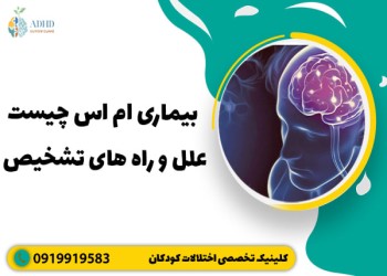 علت بیماری ام اس چیست و چه باید کرد؟