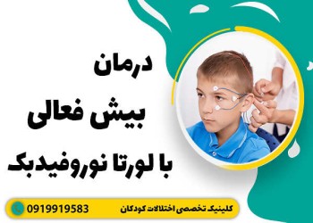 سریع ترین درمان بیش فعالی با لورتا نوروفیدبک