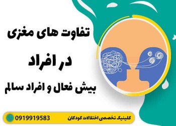 تفاوت عملکرد مغز در افراد ADHD