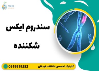 همه آنچه باید در مورد سندروم X شکننده بدانید