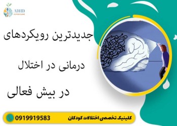 جدیدترین روش های درمانی بیش فعالی
