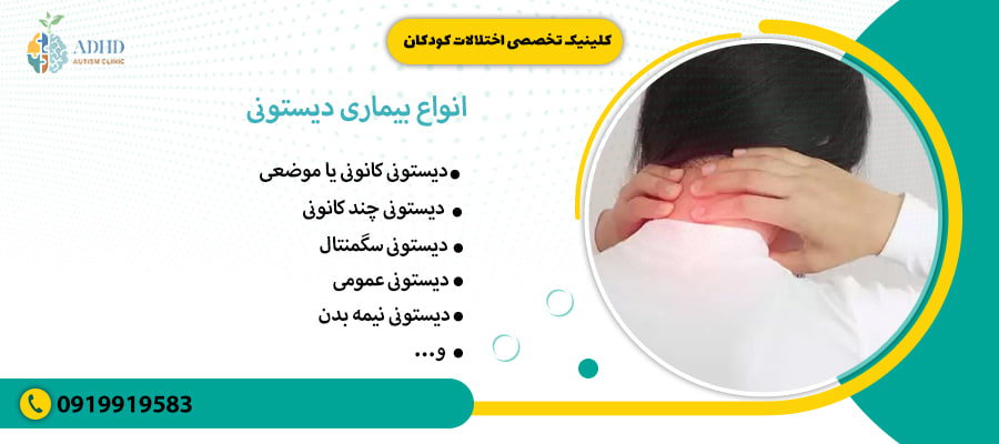 انواع بیماری دیستونی