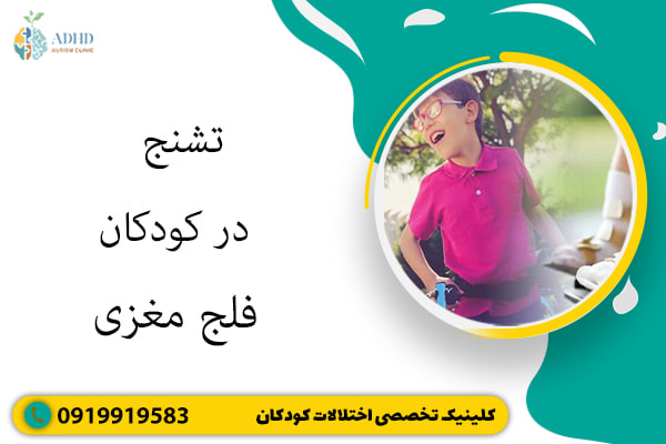 تشنج در کودکان فلج مغزی