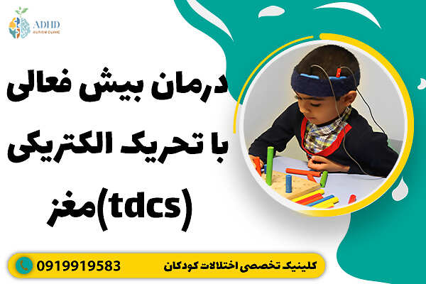 درمان پیش فعالی با تحریک الکتریکی مغز (tdcs)