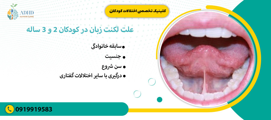 علت لکنت زبان در کودکان 2 و 3 ساله