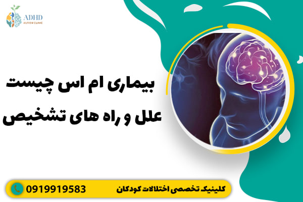 بیماری ام اس چیست + علل و راه های تشخیص