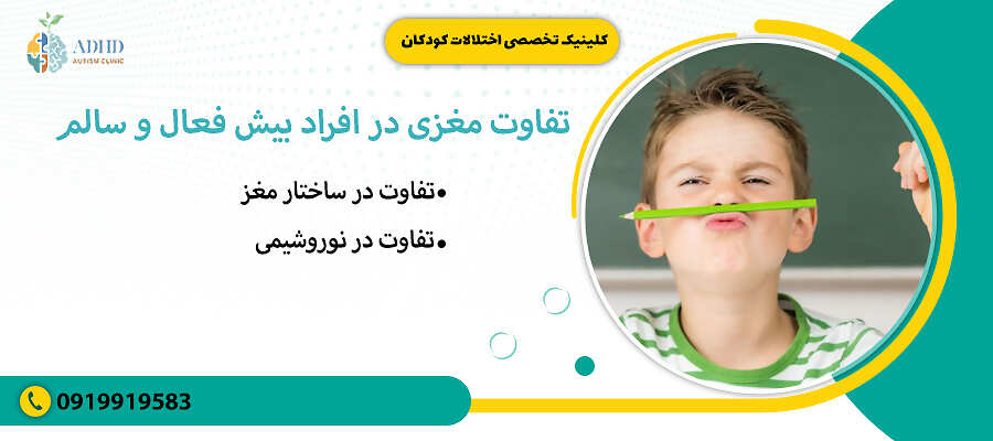 تفاوت مغزی در افراد بیش فعال و سالم