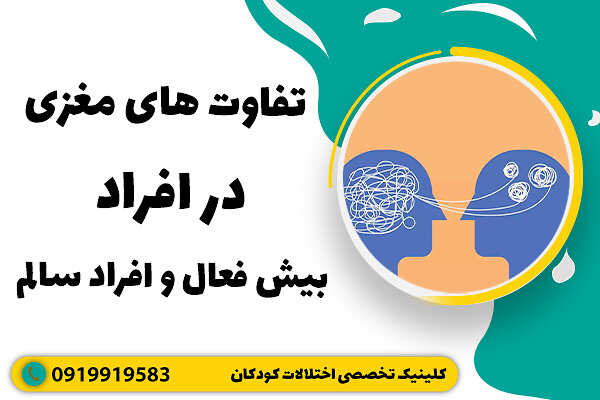 تفاوت های مغزی در افراد بیش فعال و افراد سالم