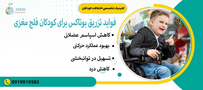 فواید تزریق بوتاکس برای کودکان فلج مغزی