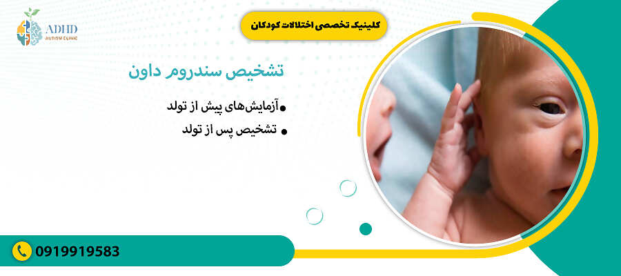تشخیص سندروم داون