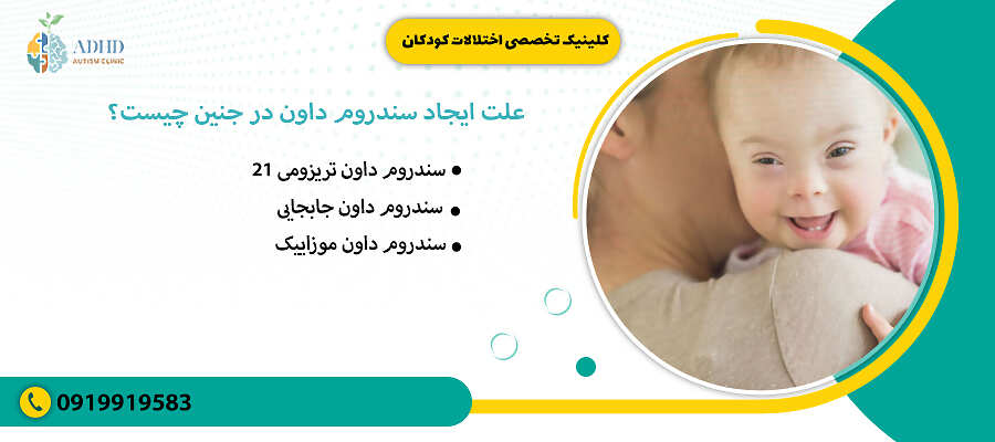 علت ایجاد سندروم داون در جنین چیست؟