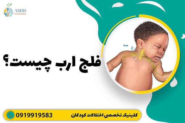 فلج ارب چیست؟